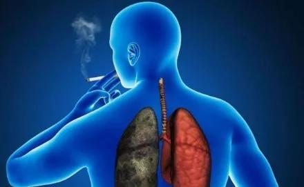 慢阻肺与肺心病有关吗,慢阻肺跟轻度呼吸障碍