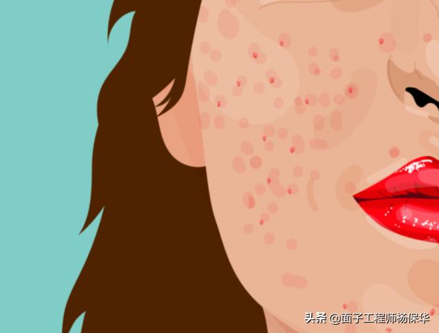 皮肤医生谈面霜,皮肤医生谈美白淡斑