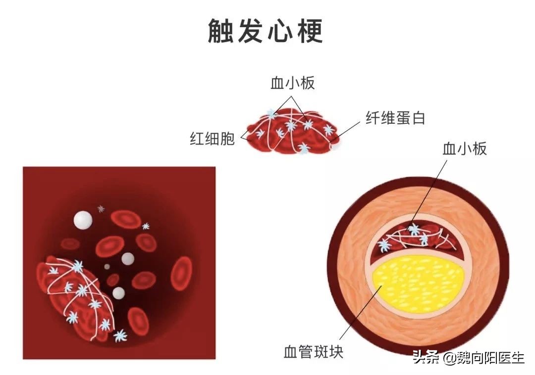 关于阿司匹林的最新资讯,最新阿司匹林信息