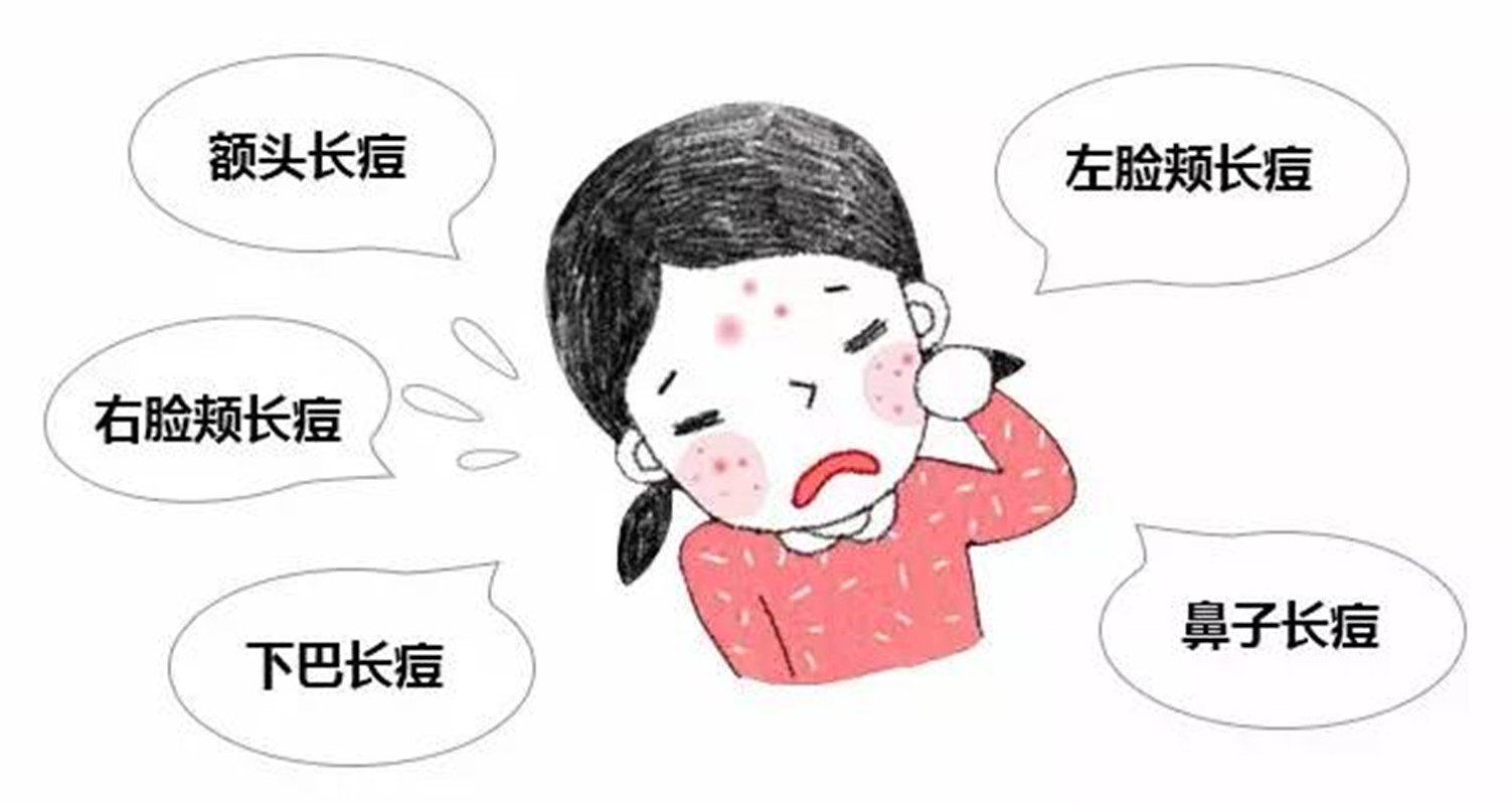 脸一直反复长痘怎么调理,脸部老是长痘痘怎么解决