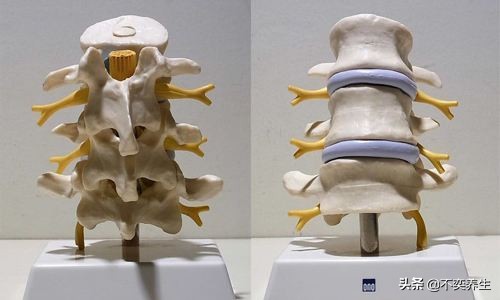 食养妙方之骨质增生