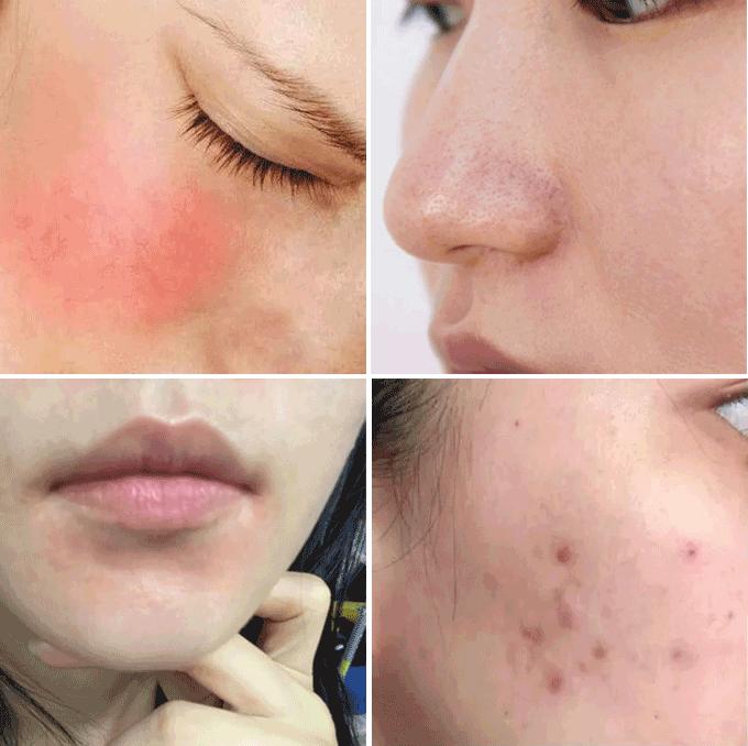 无效遮瑕测评,无效遮脸