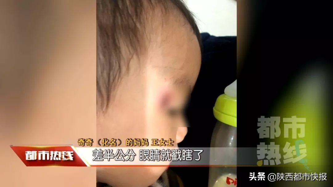 8岁小男孩眼睛被戳伤,3岁孩子游乐场被砸伤