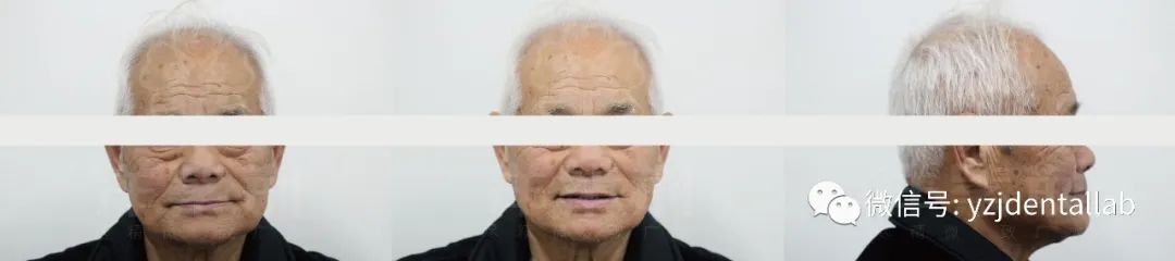 病例教学视频,病例分析操作技能