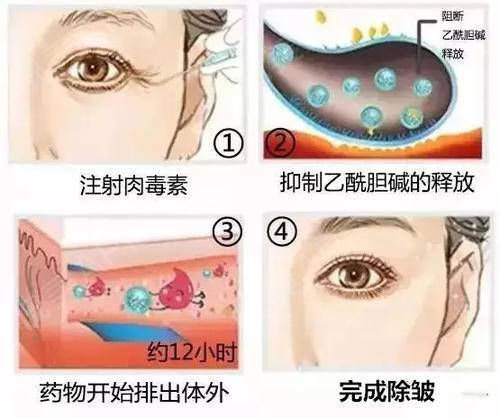 人衰老面部变化,面部衰老改善最好的方法