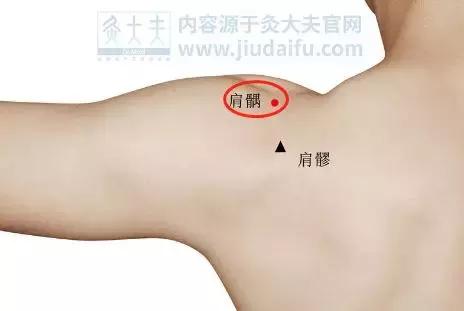 颈椎包夺命包富贵包,颈椎富贵包怎么解决