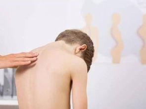 怎么知道脊柱侧弯的危害和症状,造成脊柱侧弯的原因主要是什么