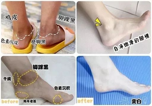 张韶涵如何抗糖,张韶涵抗老秘密