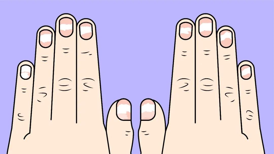 指甲长有什么不好,指甲长的有问题是怎么回事