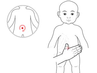 冬天儿童上火的方法,冬天儿童上火了怎样降火最快