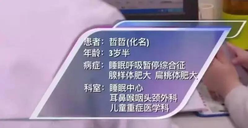 孩子腺样体肥大不手术的好方法,腺样体肥大是做手术还是保守治疗