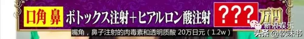 整容脸vs自然脸同龄女星对比,明明是整容脸却没被吐槽过