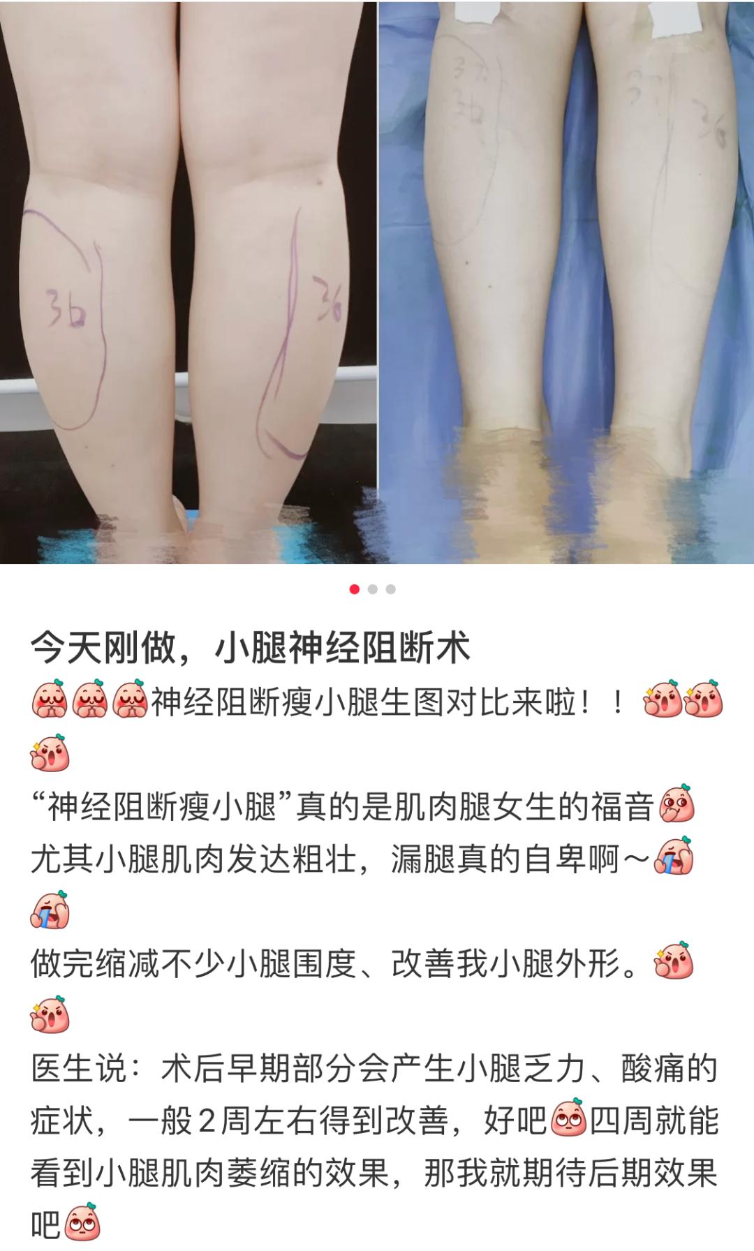 直接看呆，谁能拦住这不要命的“美”人