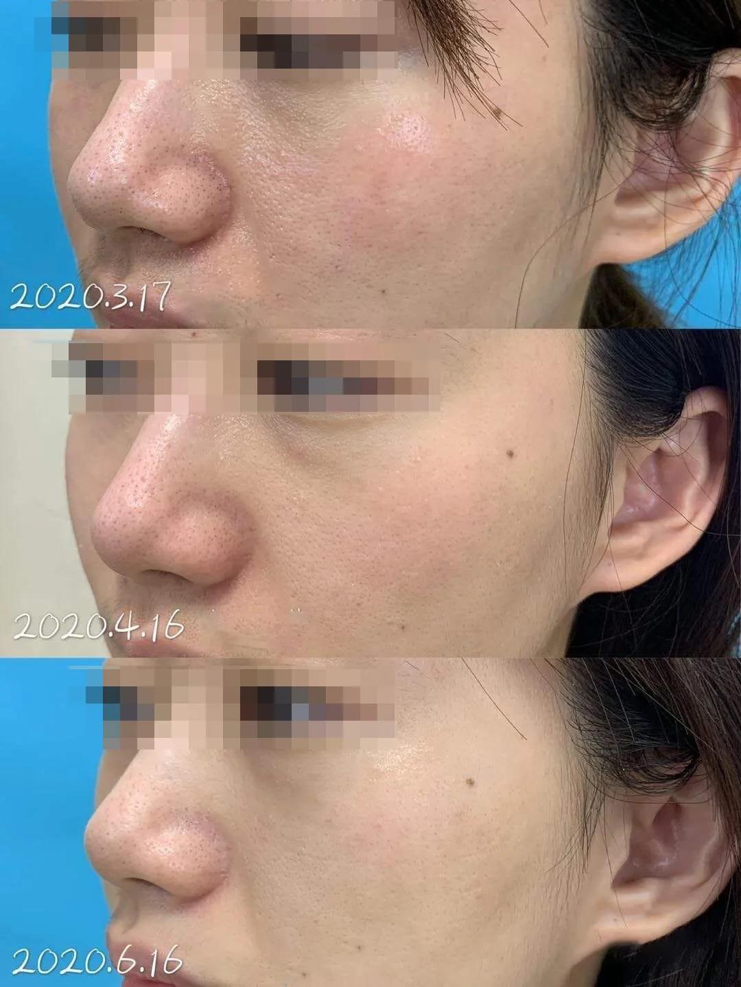 jm面膜燕窝精华好用吗,鱼子酱面膜和燕窝面膜哪种好用些