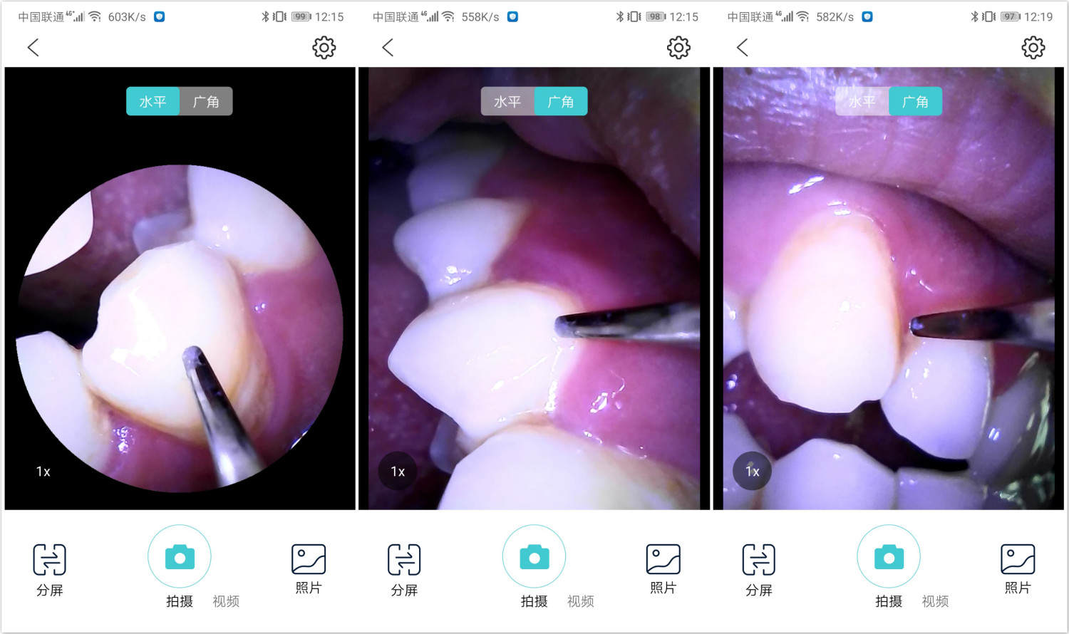 电动牙刷做不到的它可以！素诺智能可视超声波洁牙仪T11Pro测评