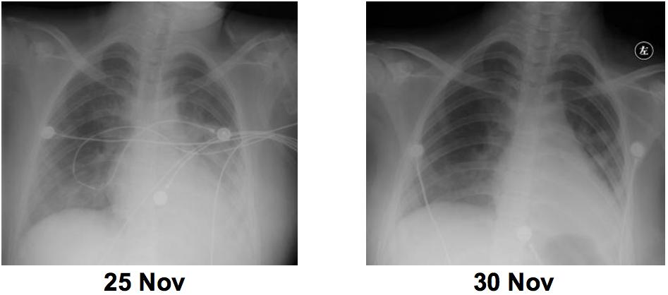 呼吸科陈荣昌,陈荣昌医学专家