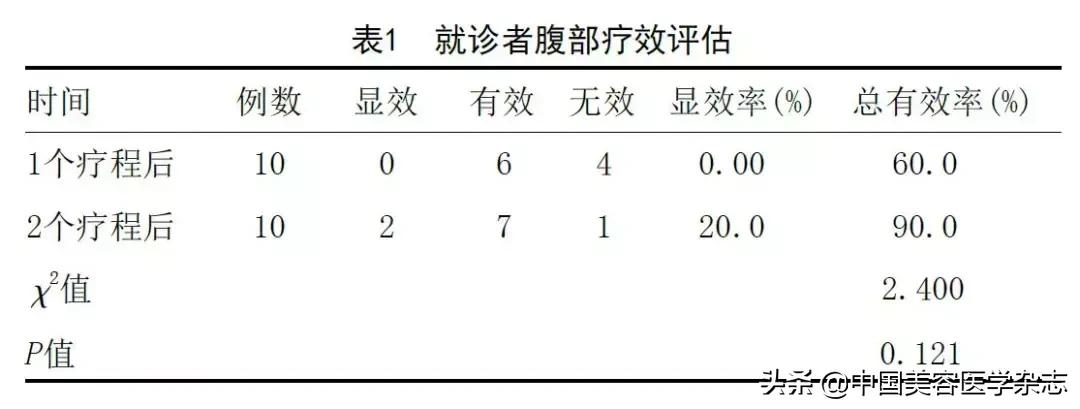 双极多通道射频联合负压治疗仪改善腹部皮肤松弛伴妊娠纹