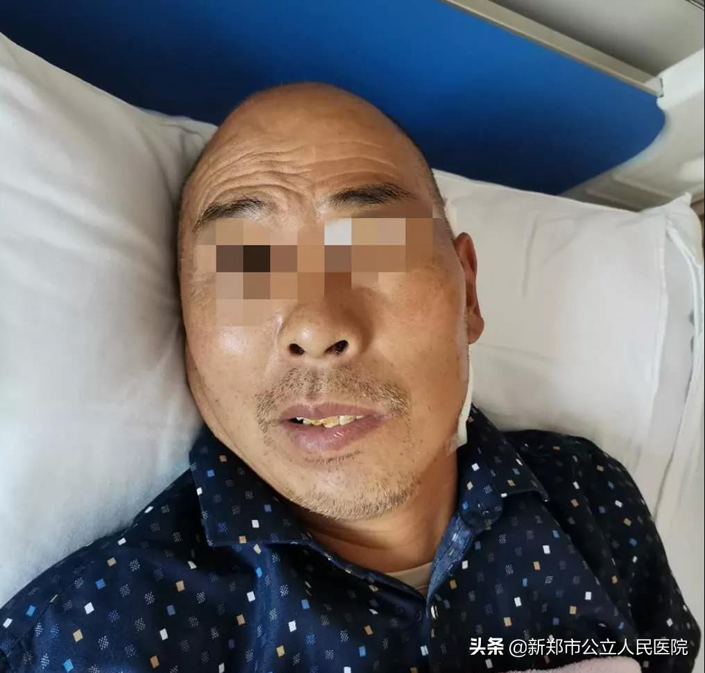 儿童面肌痉挛会频繁眨眼吗,面肌痉挛眨眼耳朵响怎么治疗