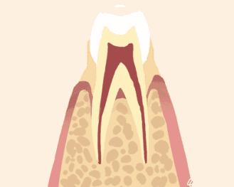 牙齿松动不疼不痒怎么回事,牙齿松动的原因不痒不痛小孩