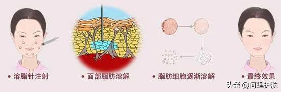 童颜针到底怎么样,美白针美白肌肤