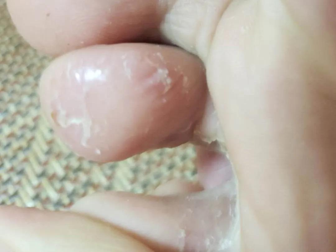 沈腾泡脚视频,沈腾谈治脚气