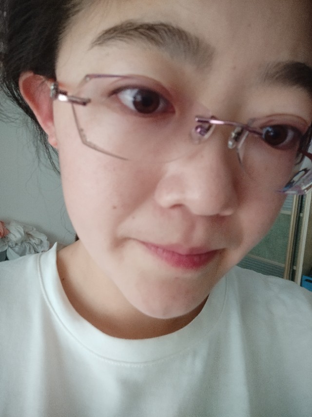 敏感肌长粉刺闭口怎么办,敏感肌发红发痒闭口怎么办