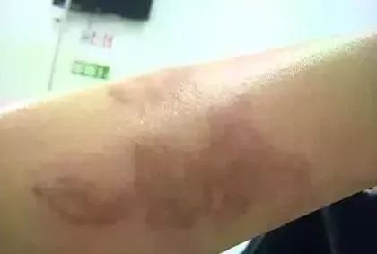 把葡萄放进微波炉爆炸实验,把两个葡萄放进微波炉