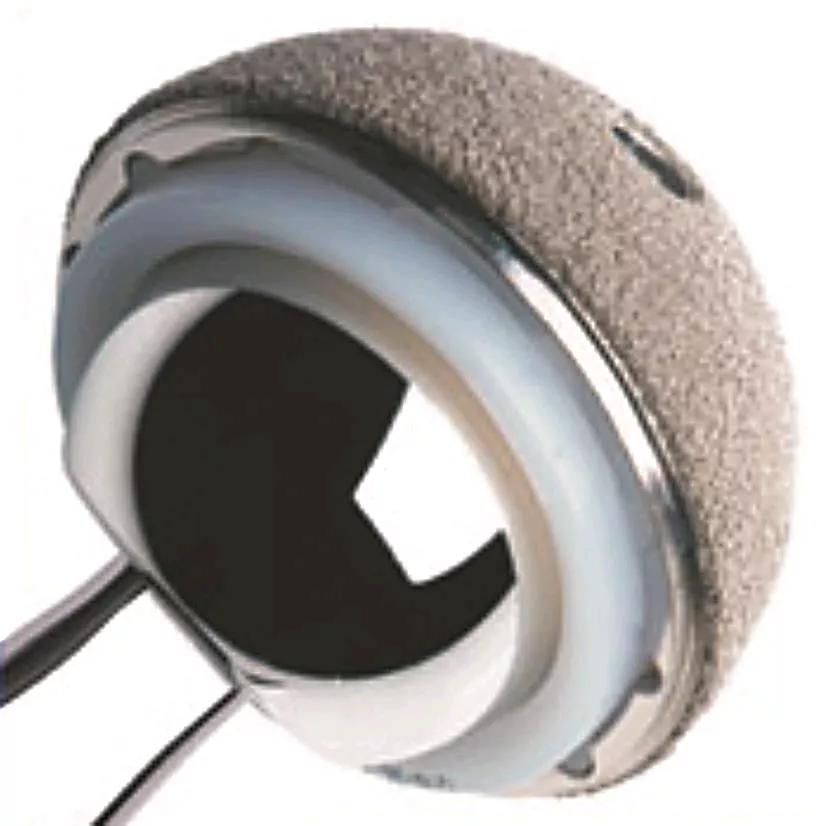 髋关节翻修术手术流程,人工髋关节翻修材料的选择