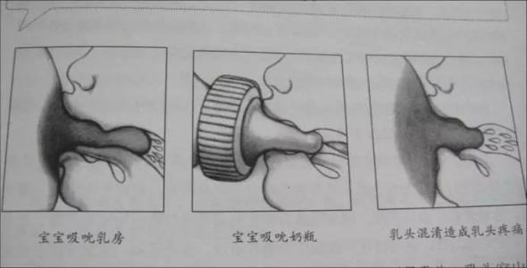 安抚奶嘴该怎么戒掉,安抚奶嘴要怎么戒掉