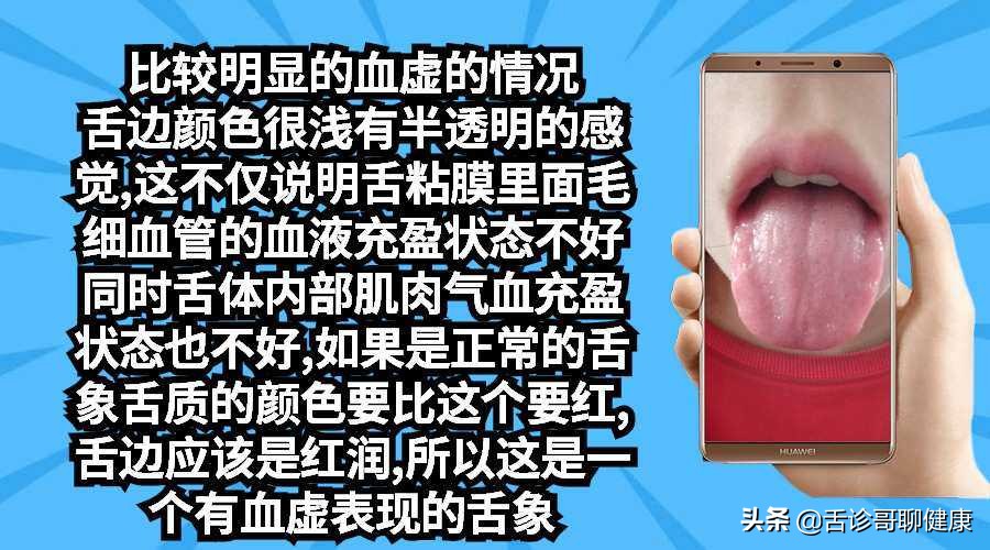 舌诊哥聊健康调脾胃,舌诊哥聊健康