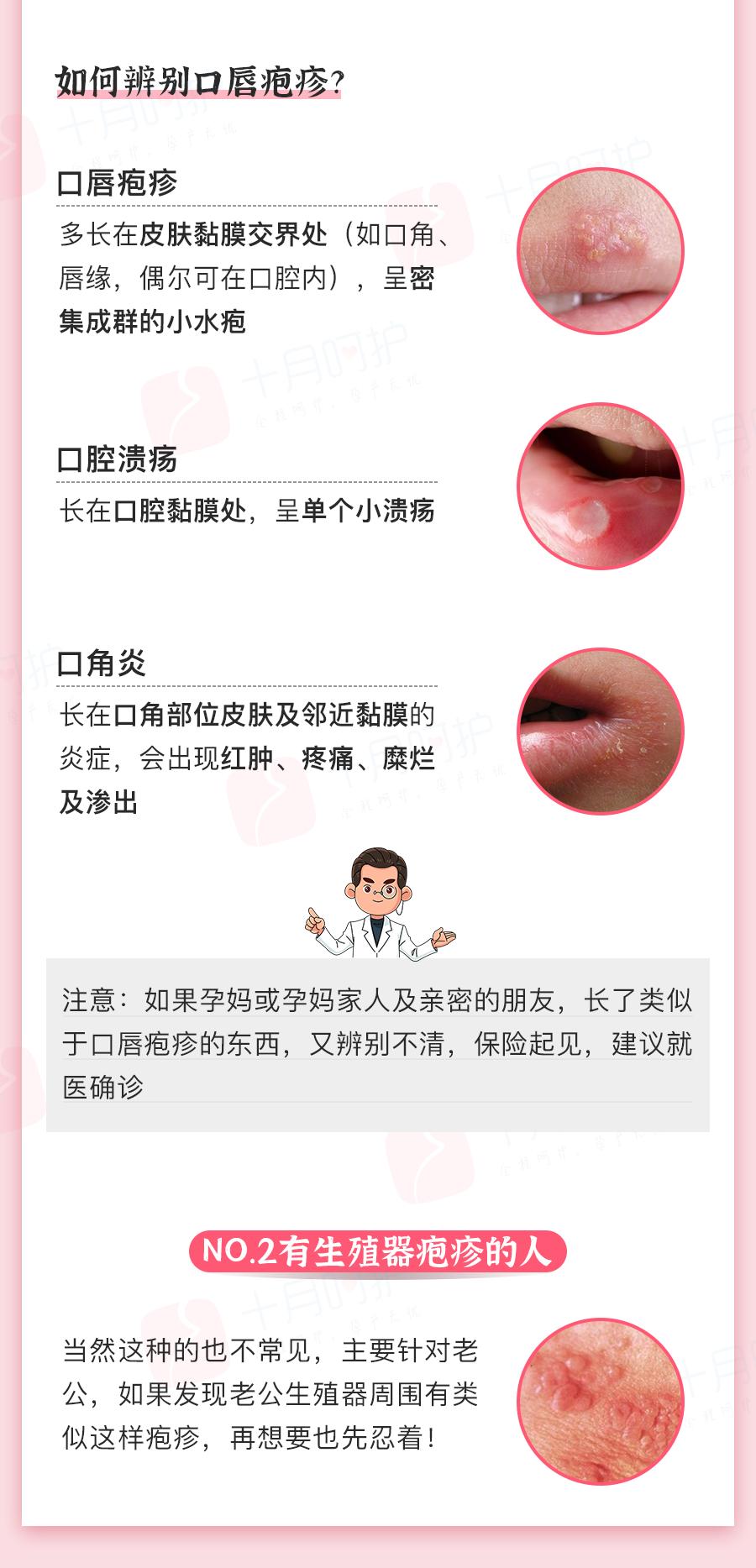 嘴上老是起泡与hpv病毒有关系吗,孕期感染hpv可怕吗