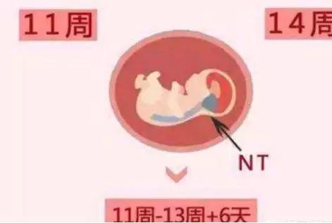 孕妇24到30周产检检查什么,准妈妈们产检排畸检查很重要