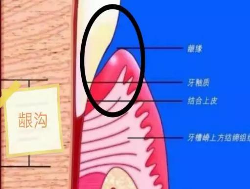 冲牙器能替代牙线,冲牙器到底能不能用