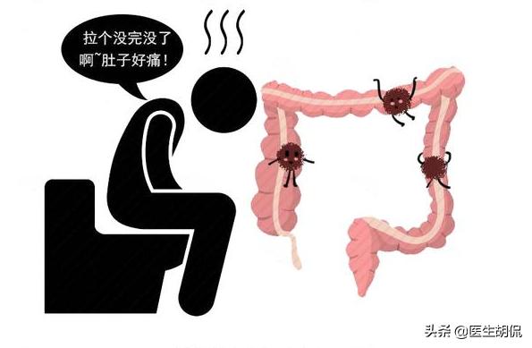 大便擦不干净是肠癌吗,上大号老是感觉排不干净擦不干净