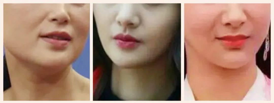 脾胃好了法令纹会改善吗,面部瑜伽能改善法令纹吗