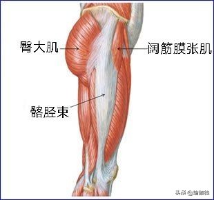阔筋膜张肌引起臀部疼痛,怎样快速治疗阔筋膜张肌