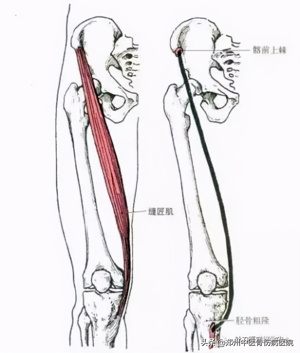 中医治疗股骨头坏死效果怎么样,中医是否可以治愈股骨头坏死