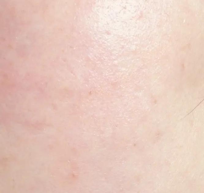 护肤精华液的正确使用方法图解,护肤干货你必须知道精华液的知识