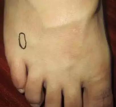 一病一绝招,治疗一病一穴奇效法