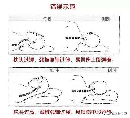 颈椎病人睡觉不枕枕头好吗,颈椎病睡觉不枕枕头好吗