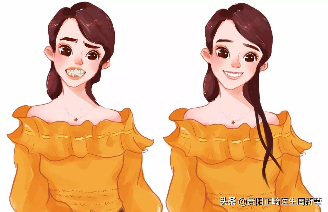 变美干货分享轻医美,矫正牙齿小干货