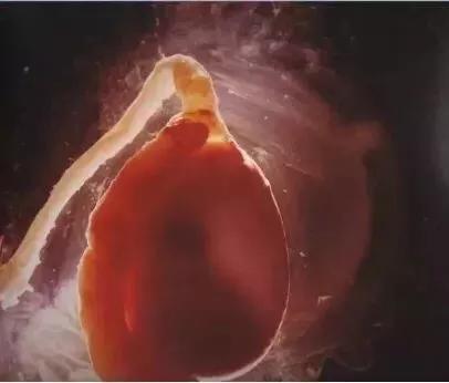 18张动图揭秘，你不是游得最快的那一个精子