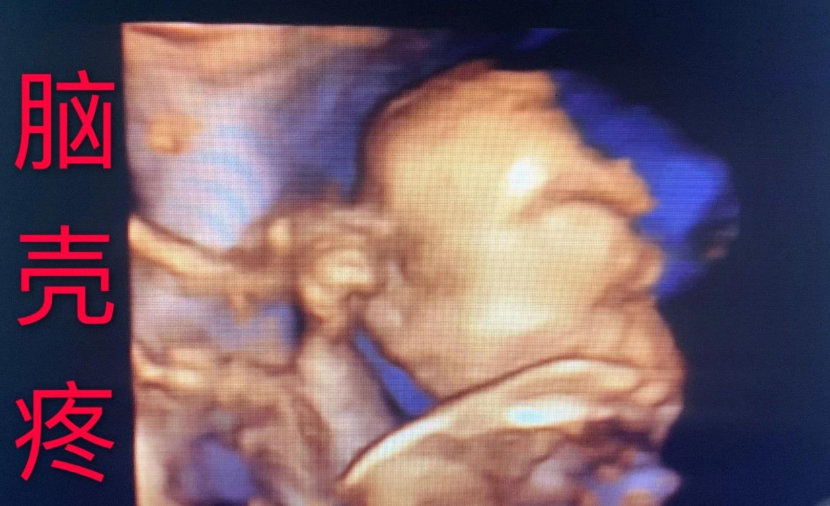 12月刚官宣当爸，40天后孩子出生，赐名小龙妹，炫耀：长得超像我