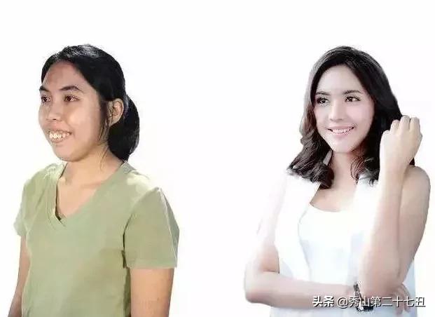 龅牙妹因为丑生活处处受挫，下定决心整容后，人生发生大翻转