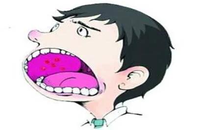 胃食管反流吃饭后口酸过一会好转,病人嘴巴感觉甜是什么意思