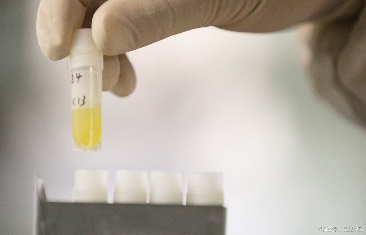 精子不液化和精子弱的区别,精子不液化和不完全液化有区别吗