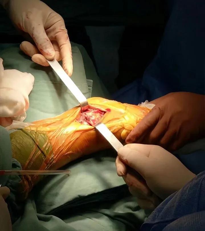 女性可以当骨科医生吗,为什么选择做骨科医生