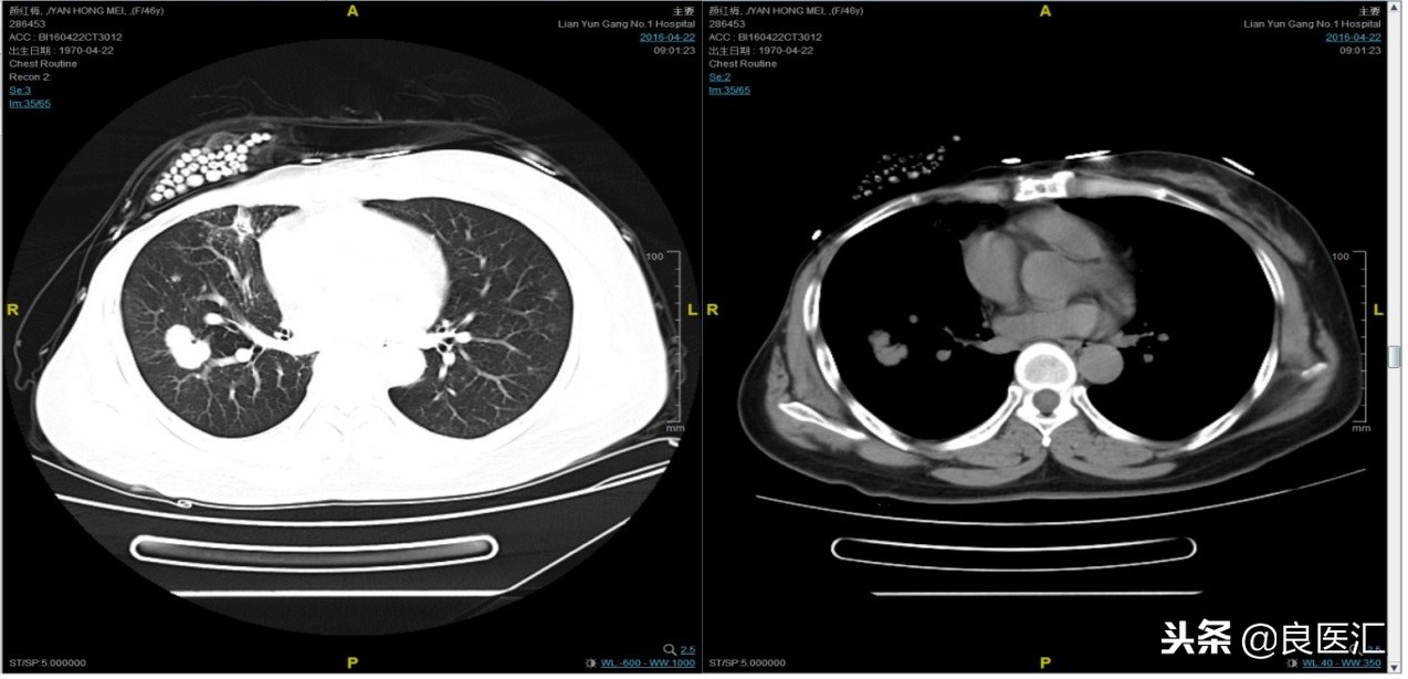 美图秀秀成功案例,美图秀秀实战案例