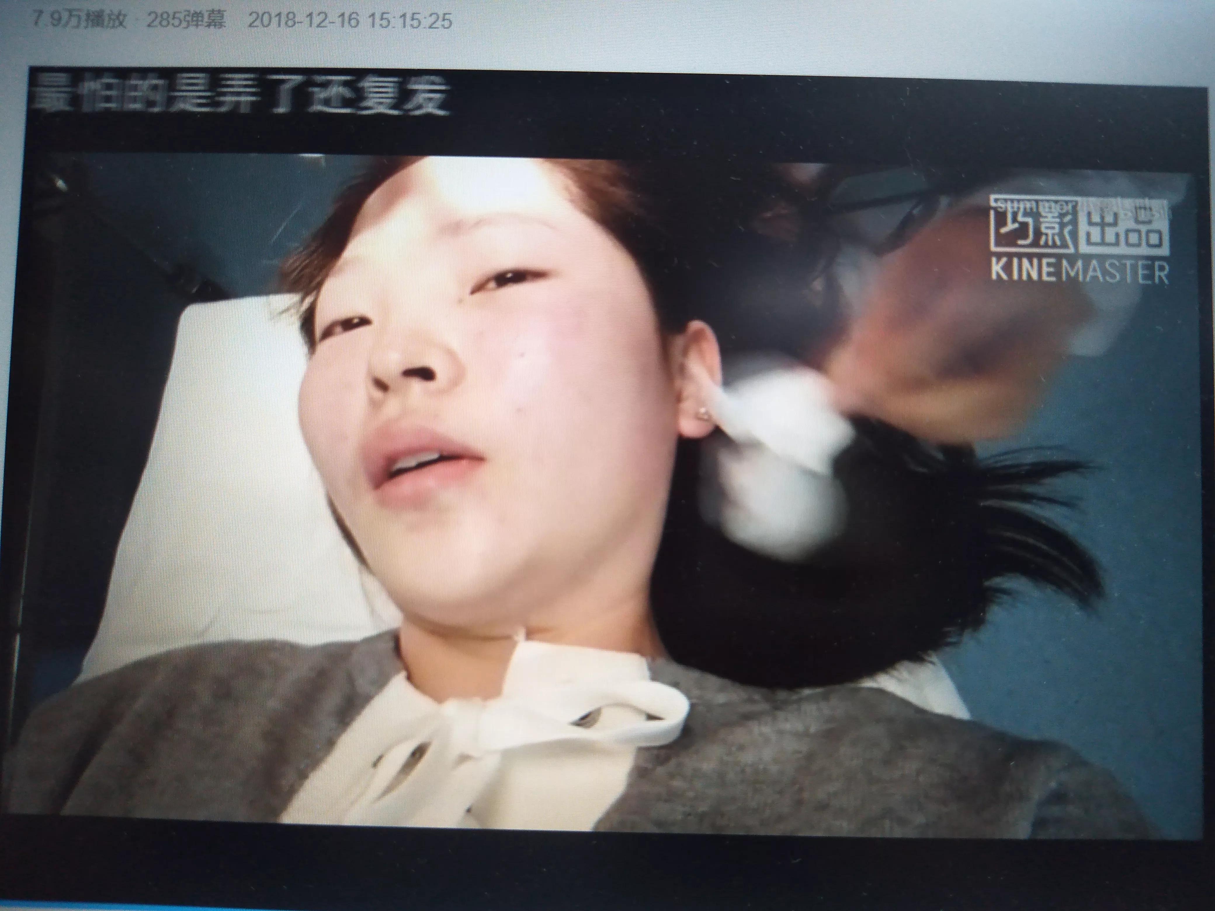 脸上的痣可以点掉吗相学,脸上的痣有毛能不能点掉