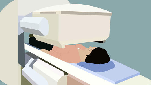 胆管肿瘤放疗有哪些副作用,头部肿瘤放疗有什么副作用